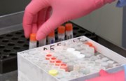 Vakcína proti rakovině od Moderny snižuje v testech počet úmrtí spolu s léčivem od Mercku