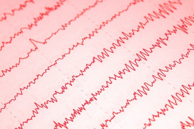 Rozbřesk: Dojdou v tomto týdnu trhům pozitivní stimuly?