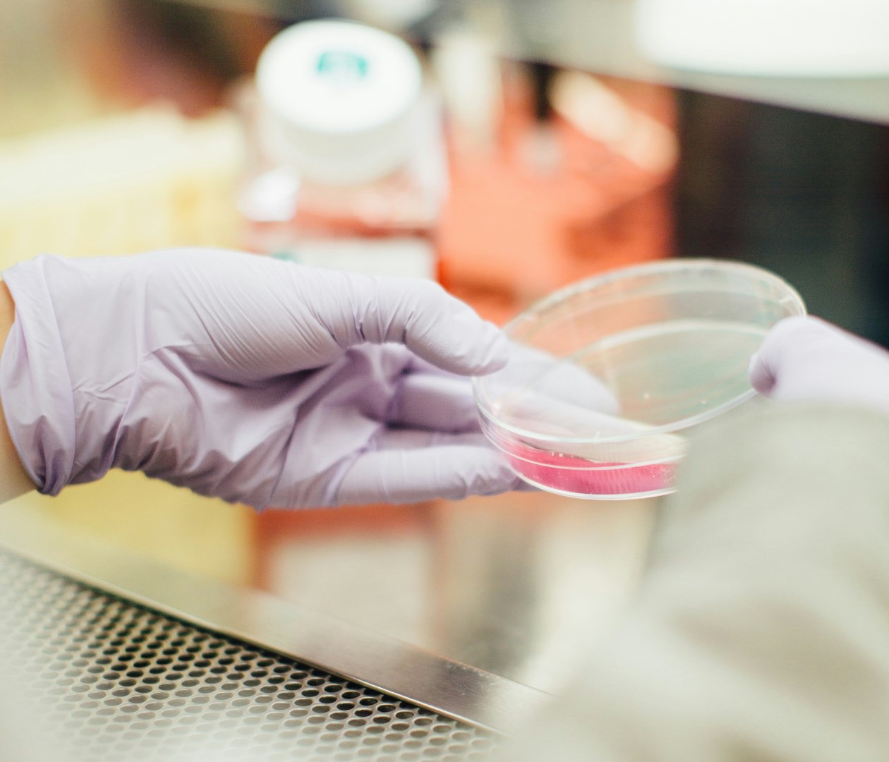 Abbott koupí za 21 miliard dolarů výrobce testů na rakovinu Exact Sciences