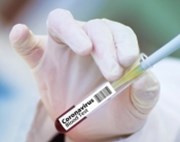 Britská AstraZeneca pozastavila testování koronavirové vakcíny